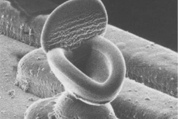 失效分析之电子篇：扫描电子显微镜分析